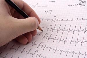 EKG: normen for grunnleggende indikatorer