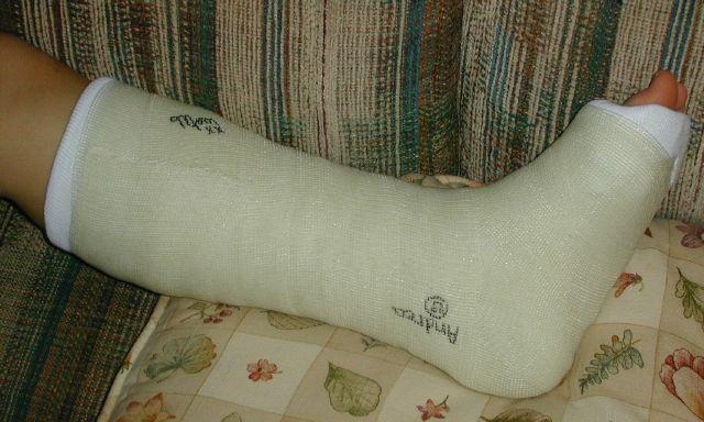 Gips dressing regler