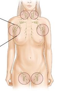 Hvorfor blir lymfeknuter i lysken hos kvinner betent?