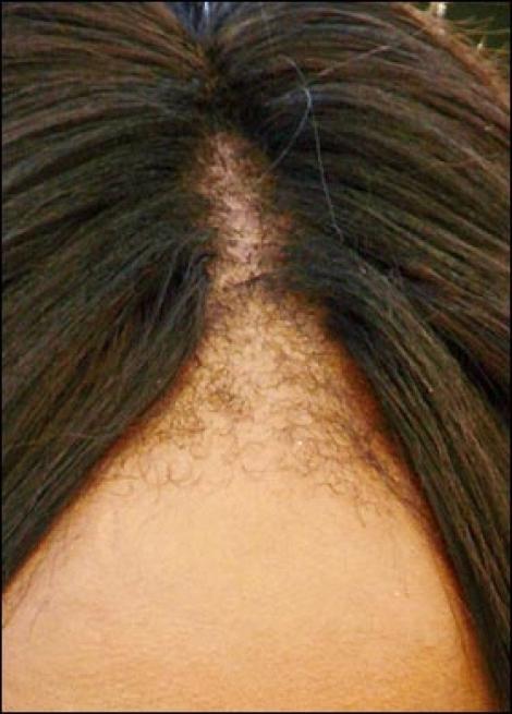 Midler mot håravfall: finn og eliminere årsaken